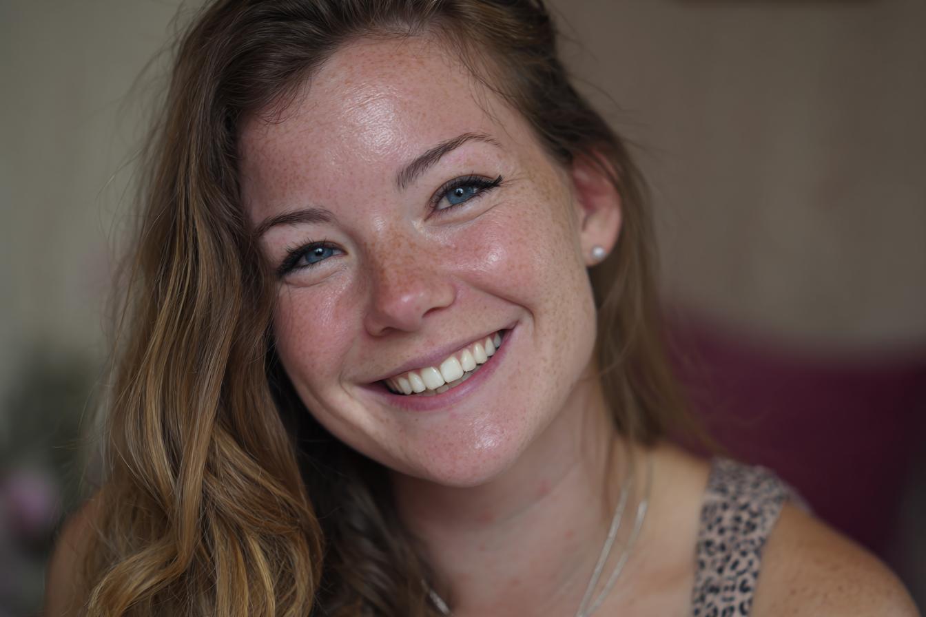 Nikon D500   85mm F2.2 Iso 400 1250s Uneven Skin Tones With S